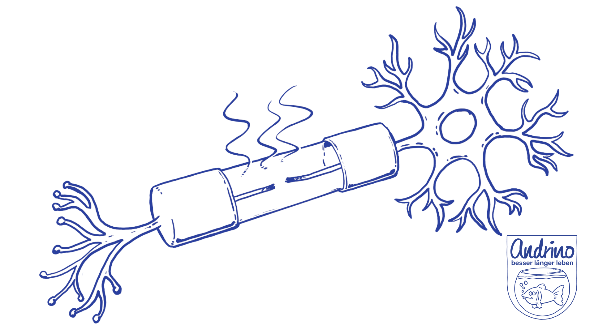 Ich habe ein fieses Los gezogen. Es heißt ideopathische Epilepsie!