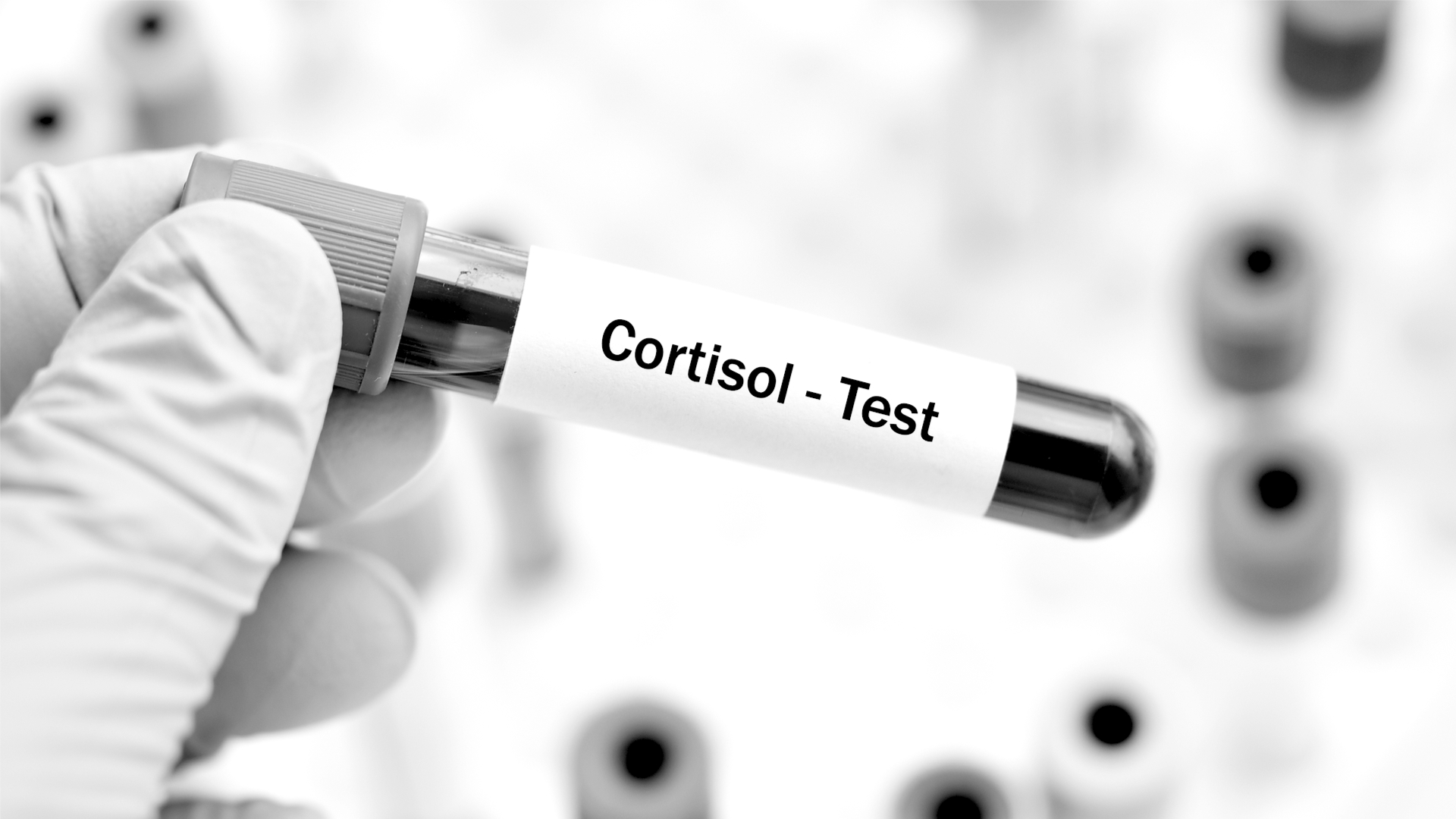 Cortisol-Tagesprofil: dauerhaft gestresst?